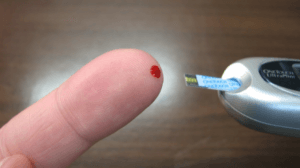Vércukorszint-mérés a vérző ujjbeggyel.
